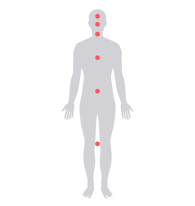 Human body with red dot hotspots