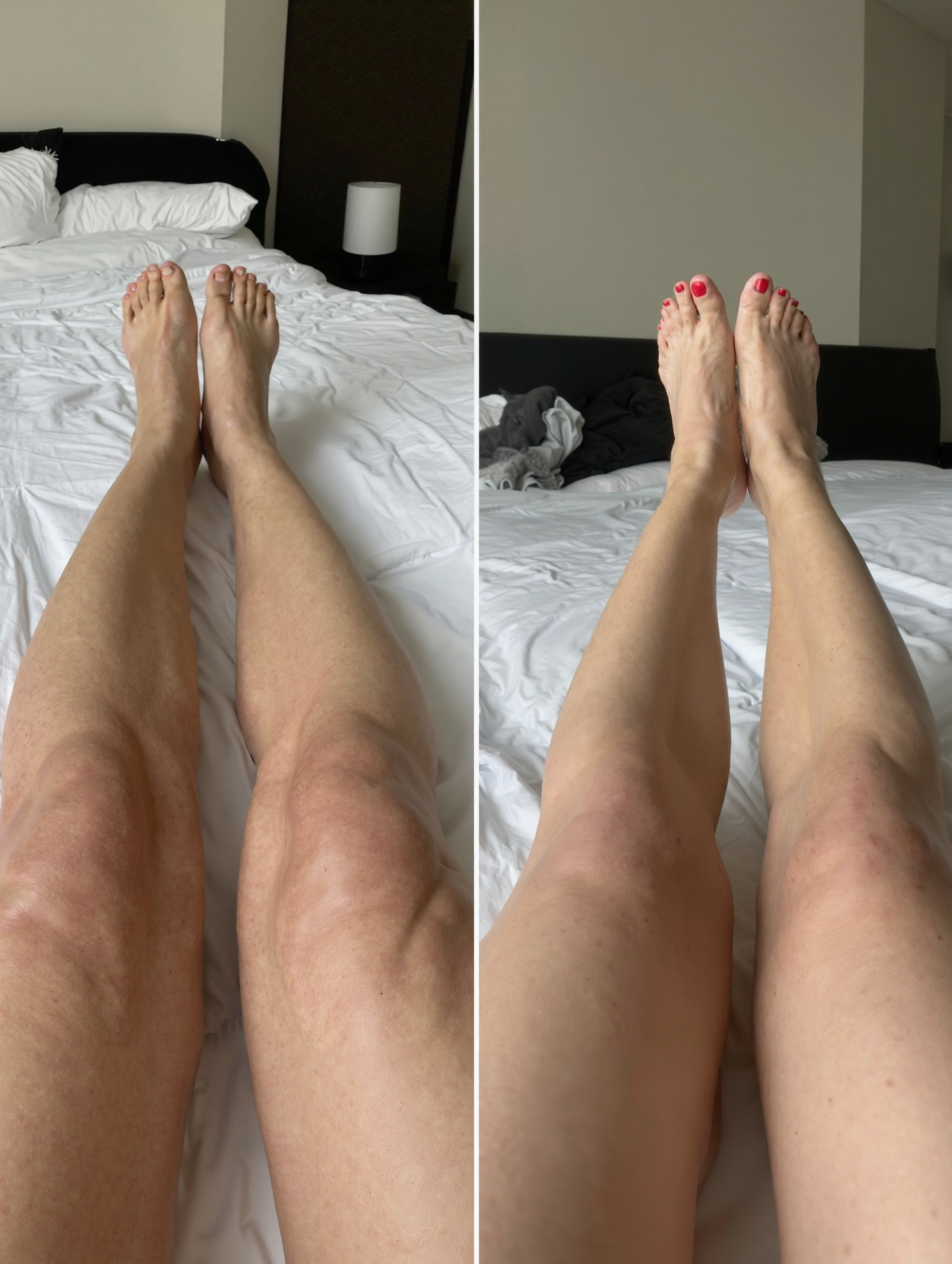 Two side-by-side images of legs resting on a bed.