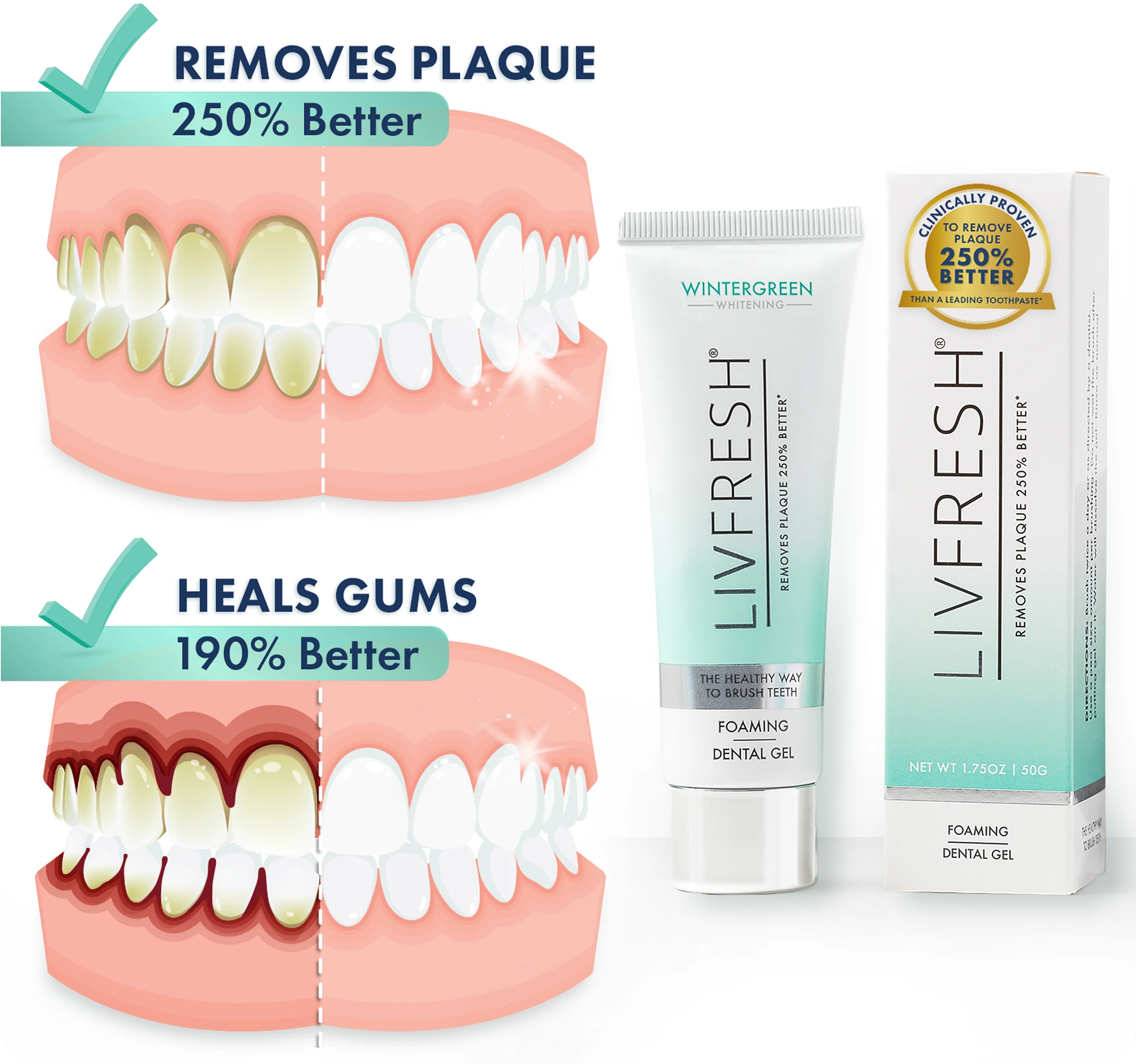 Dental gel advertisement showing plaque removal and gum healing benefits.