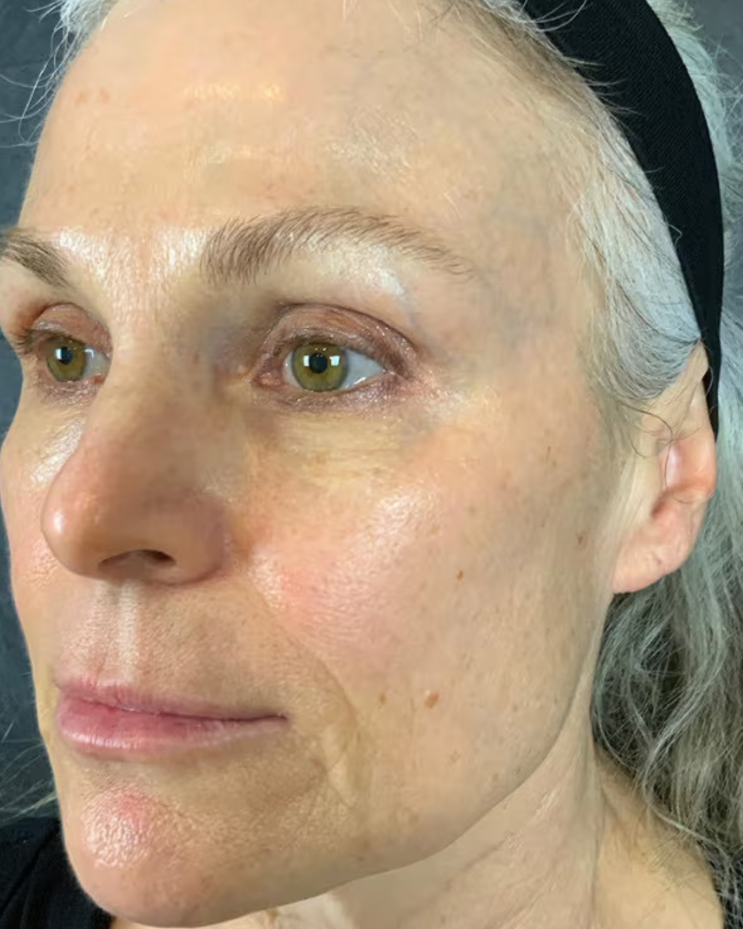 Close-up of a person's face with a neutral expression, wearing a black headband.