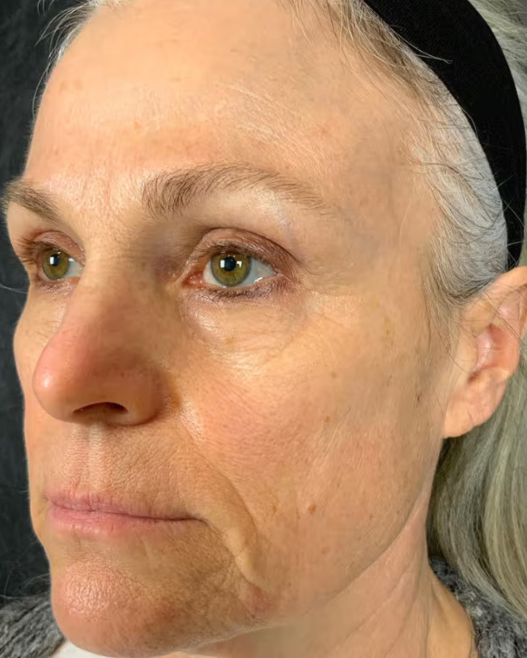 Close-up of an older woman's face with visible wrinkles and gray hair.