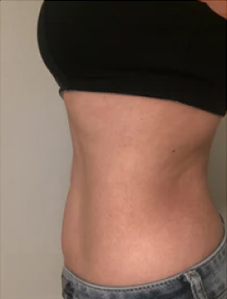 Side view of a person's torso wearing a black top and jeans.