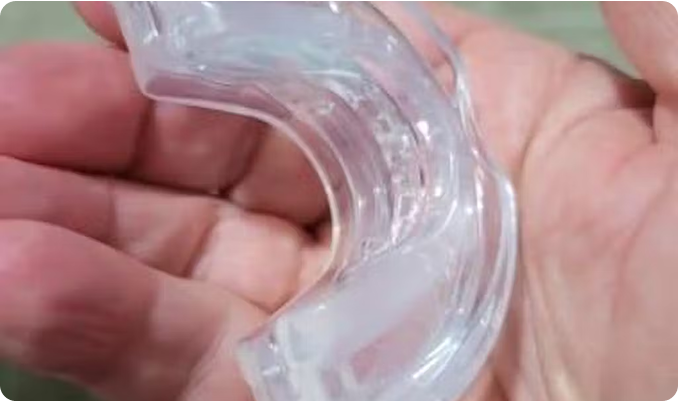 A clear dental mouthguard held in a person's hand.