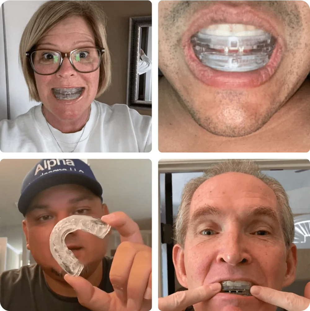 Four people demonstrate mouth guards in a collage.