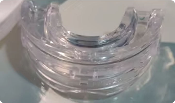 Clear dental mouthguard on a reflective surface.