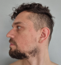 Profile view of a man with curly hair and beard against a plain background.