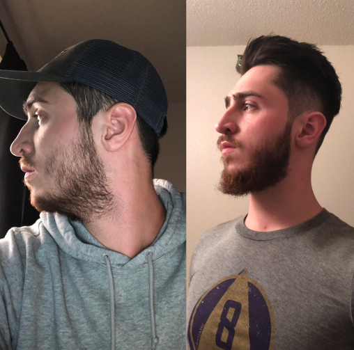 Two profile photos of a man with a beard, wearing a cap and hoodie on the left.