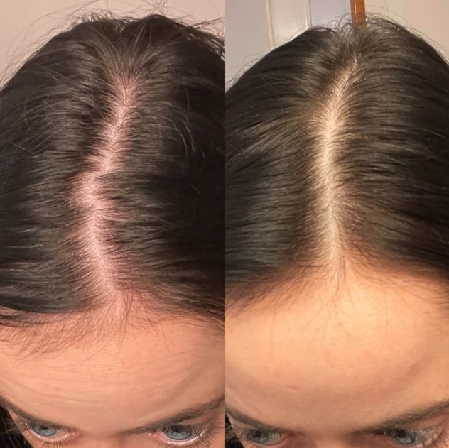 Side-by-side comparison of a person's hair part with a visible improvement.