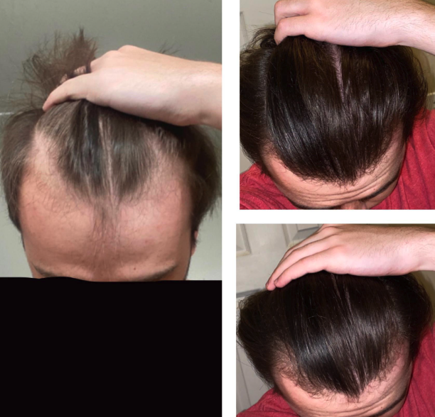 Collage of three images showing a person checking hair on the top of their head.