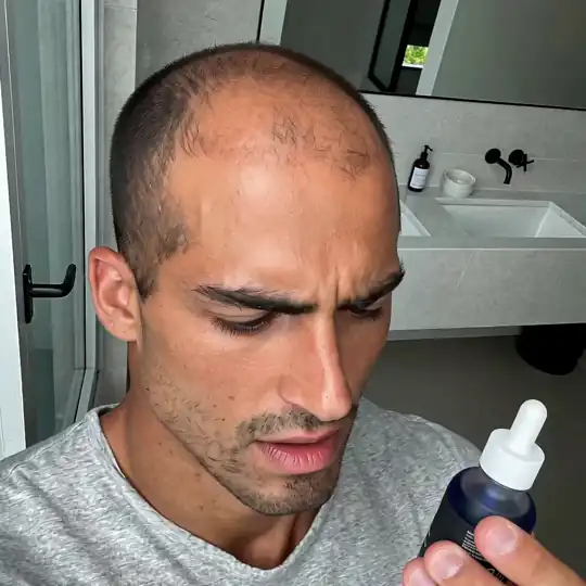 A man with thinning hair looks down at a small bottle with a dropper in his hand.