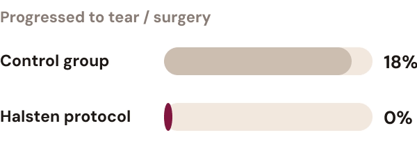 0% progressed to tear or surgery vs 18% in the control group