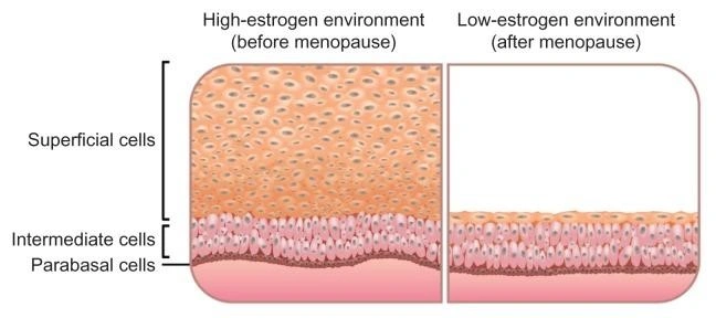 Diagram comparing cell layers in high and low estrogen environments.