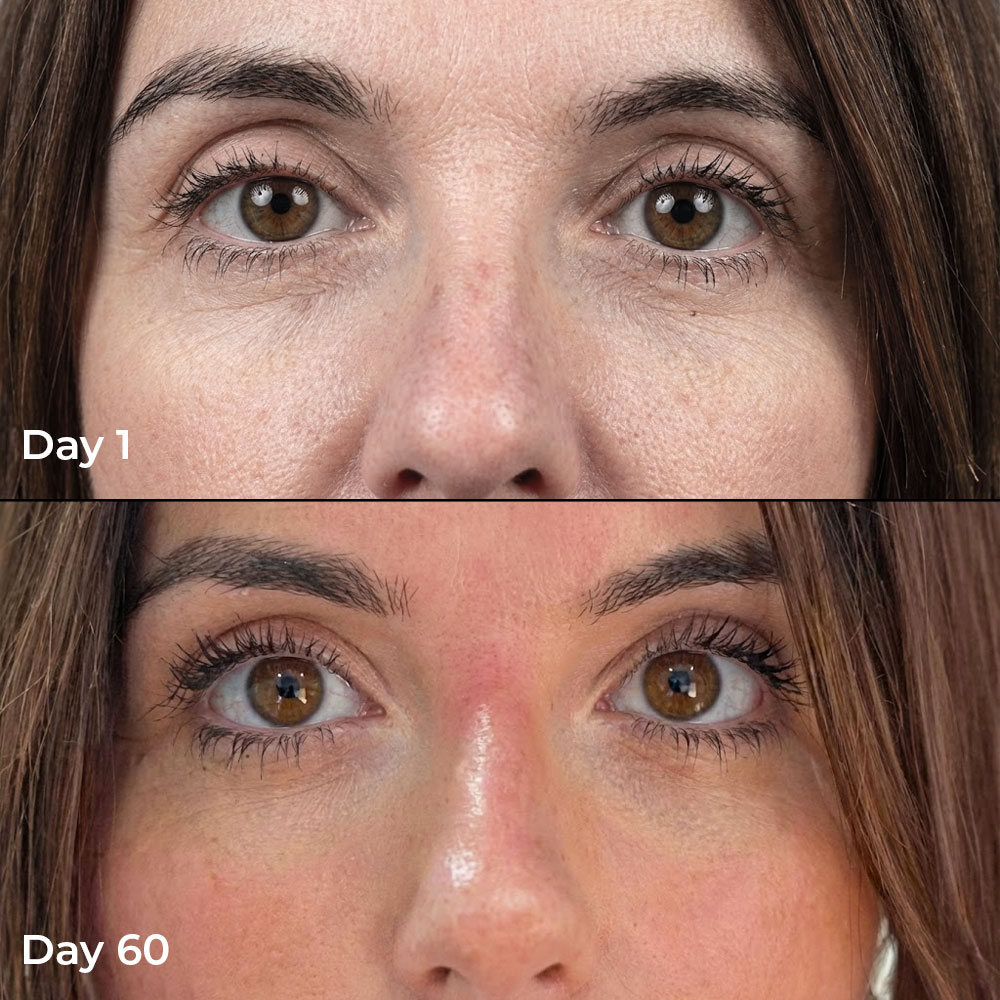 A before and after image showing a close-up of a woman's eyes, from Day 1 to Day 60.