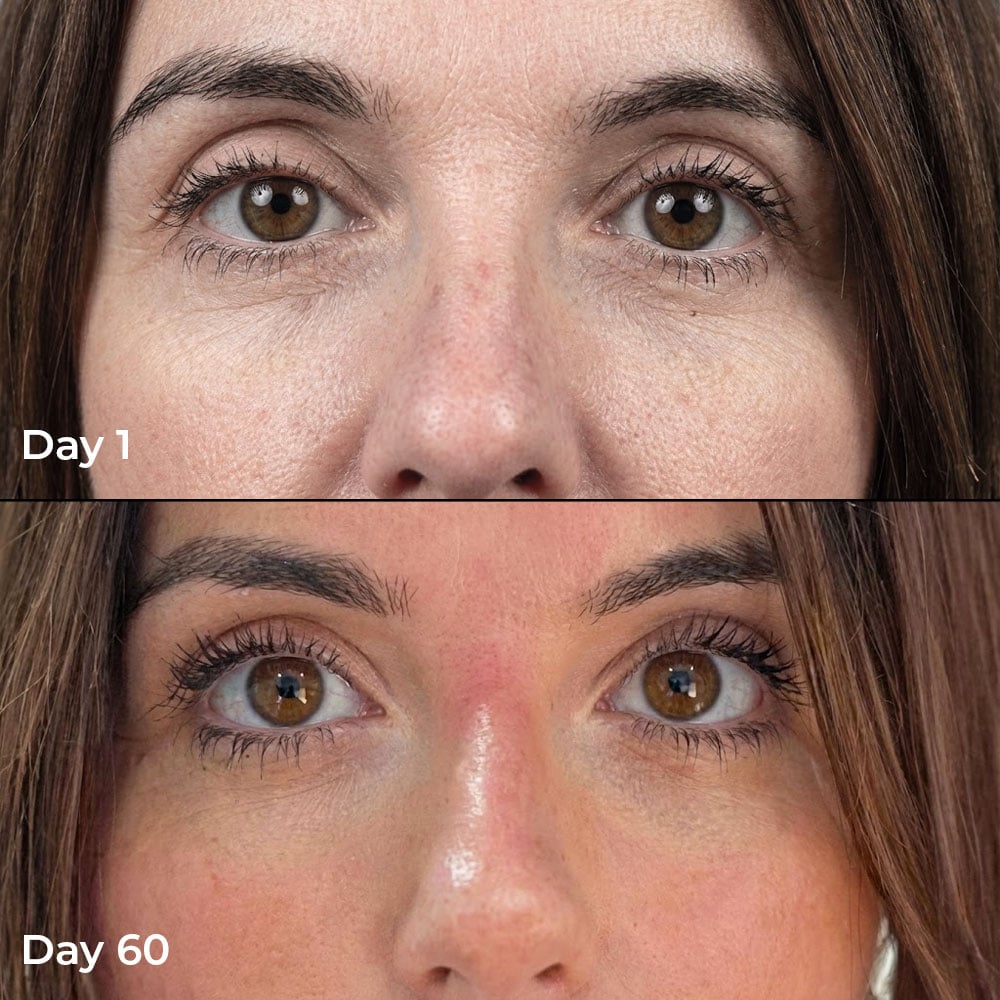 Day 1 to Day 60 before after
