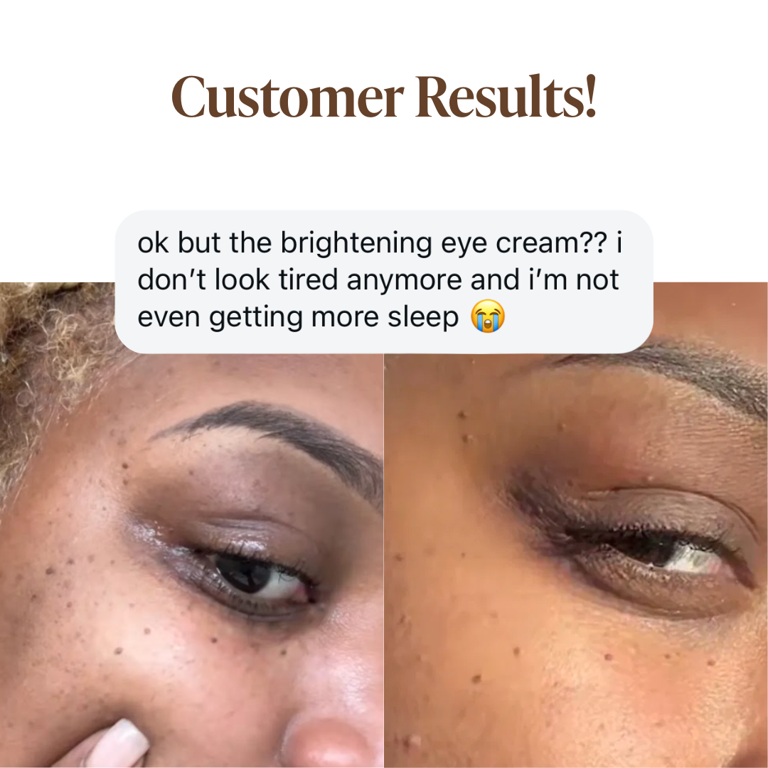 Before and after photos of eyes with text above about brightening eye cream results.