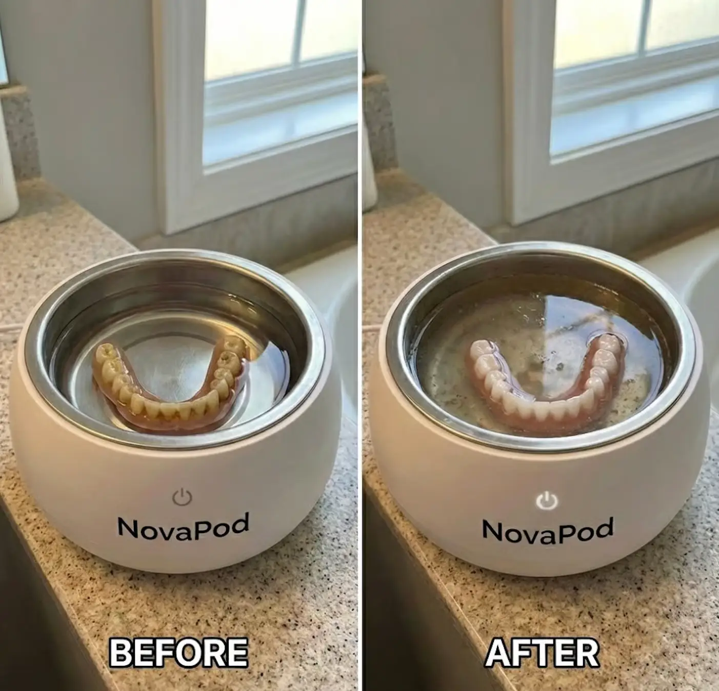 A before-and-after image showing dentures getting visibly whiter after being cleaned in a NovaPod device.