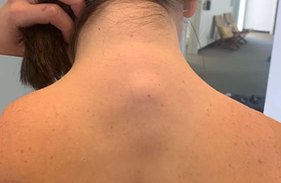 Close-up of a person's neck and upper back with hair held up.