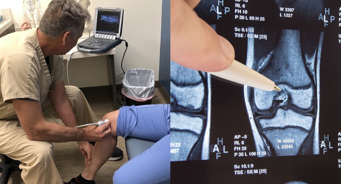 Doctor performing knee ultrasound and pointing at MRI scan.
