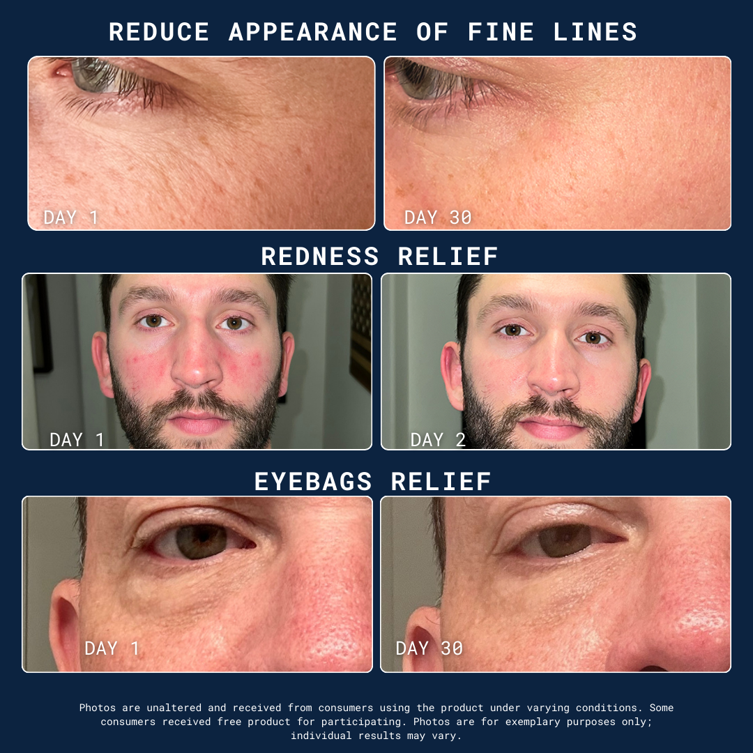 Three before-and-after comparisons for skin appearance improvement.