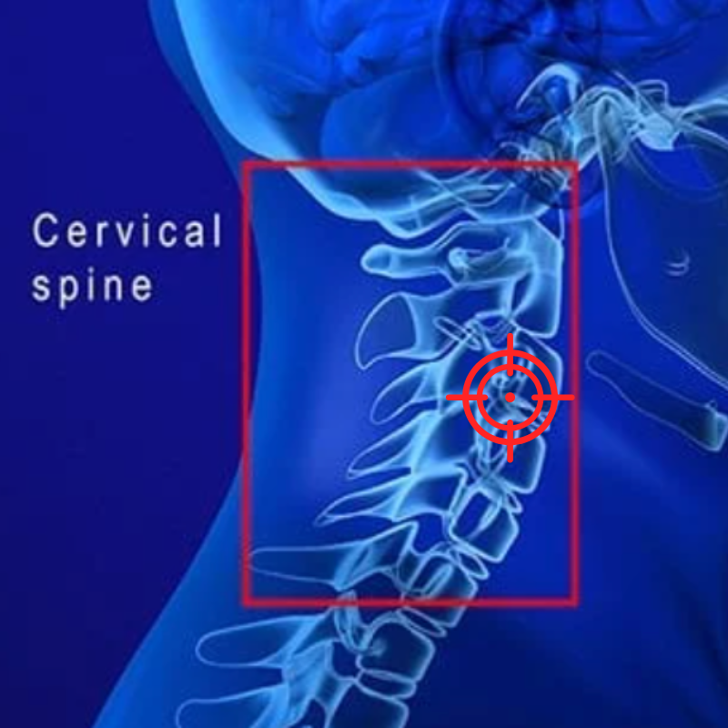 X-ray illustration of the cervical spine with a red target symbol.