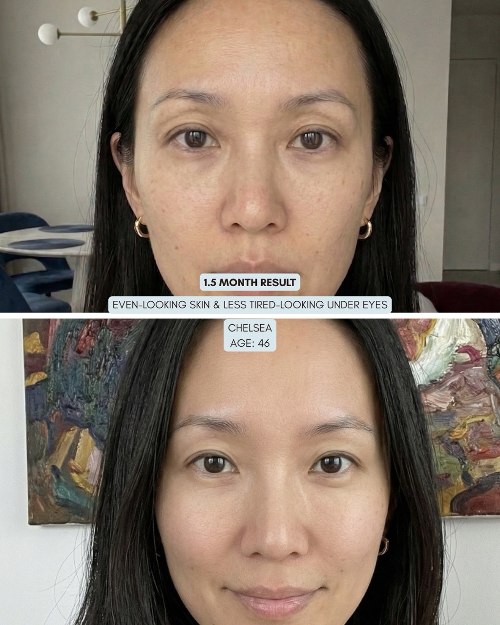 A before and after image showing a woman's skincare results over 1.5 months, with improved under-eye appearance.