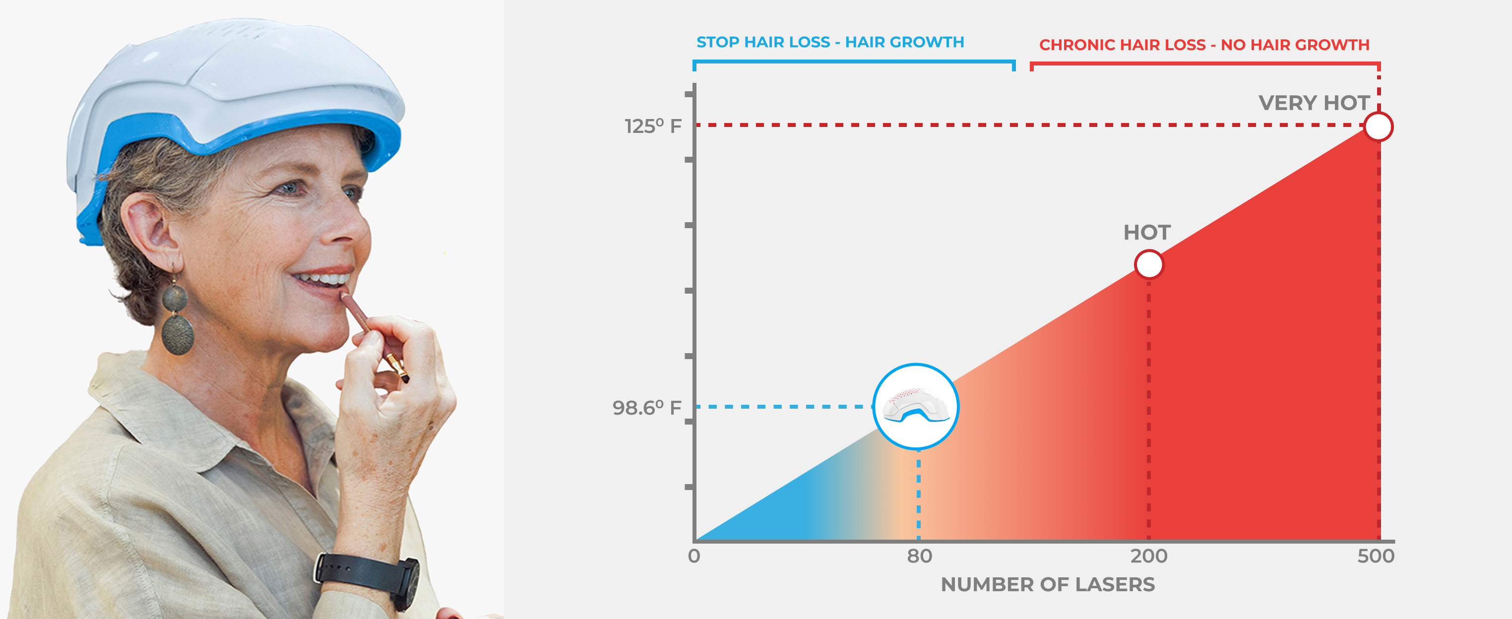 Woman wearing hair growth helmet, applying lipstick; temperature-laser chart beside her.