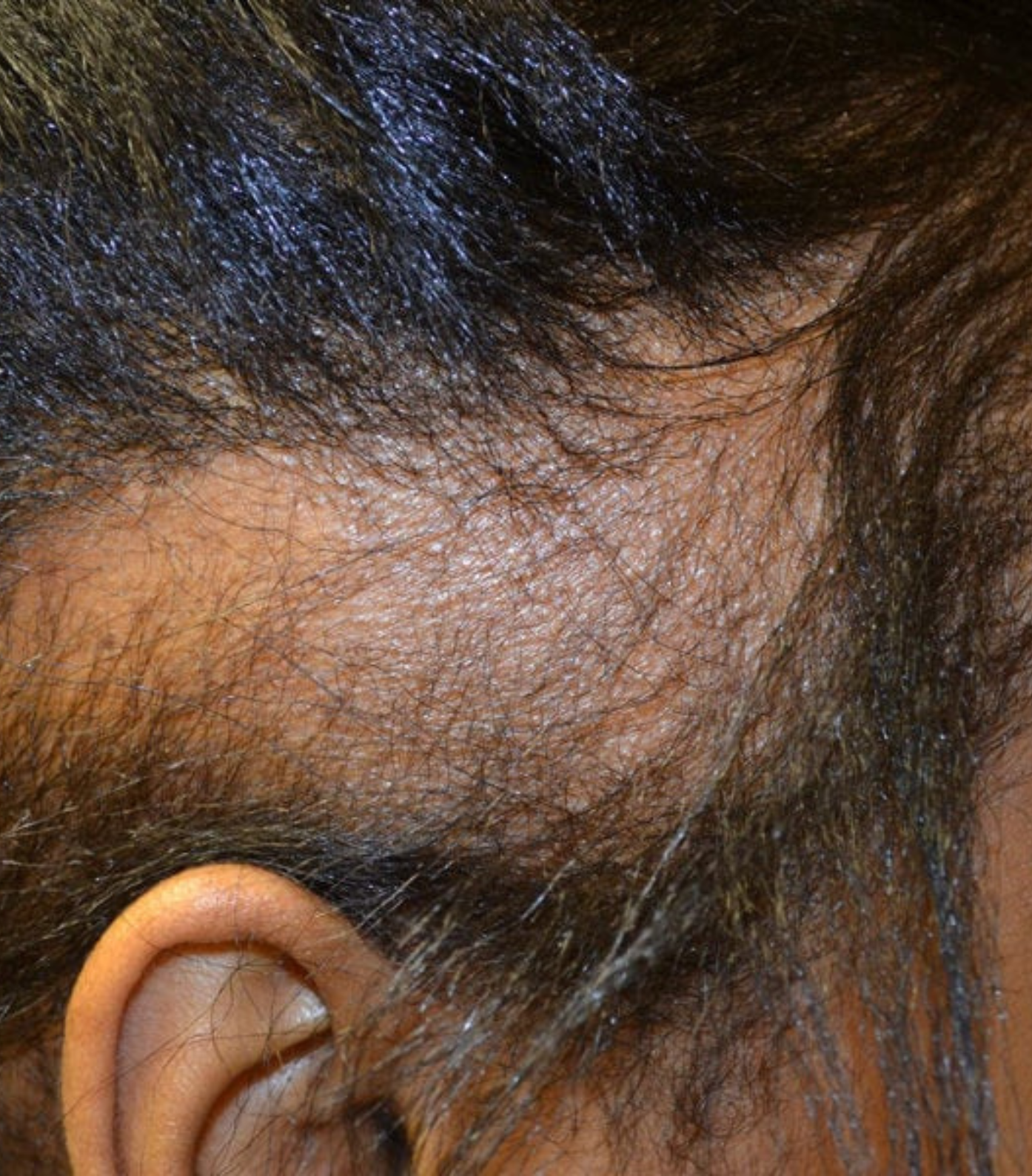 Close-up of a person's ear and hairline with thinning hair.