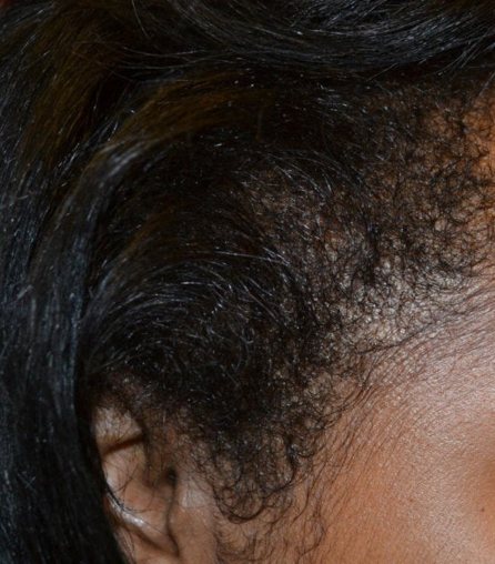 Close-up of the side of a person's head with dark, curly hair.