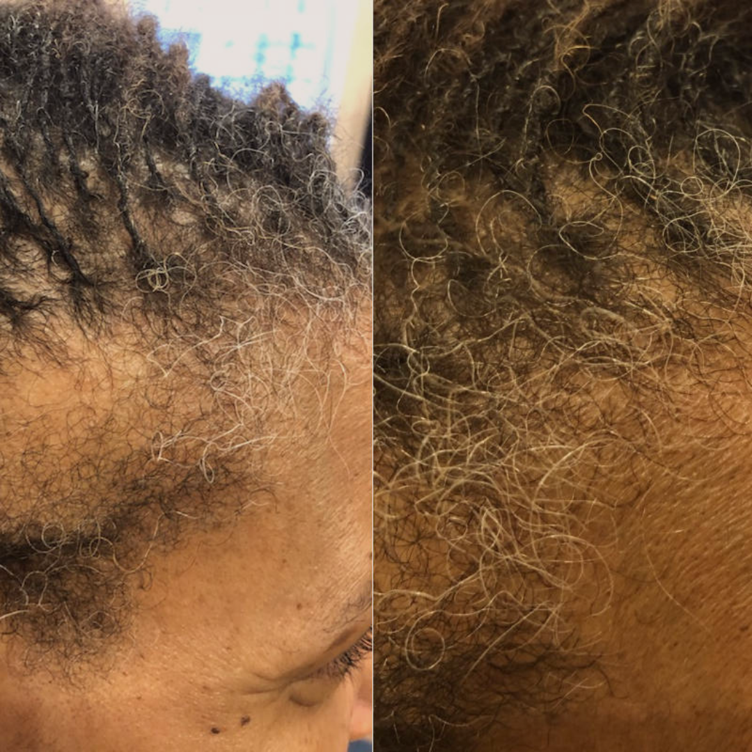 Close-up of textured hair showing scalp and hairline.