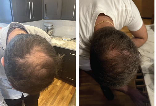 Two men with thinning hair viewed from above in a kitchen setting.