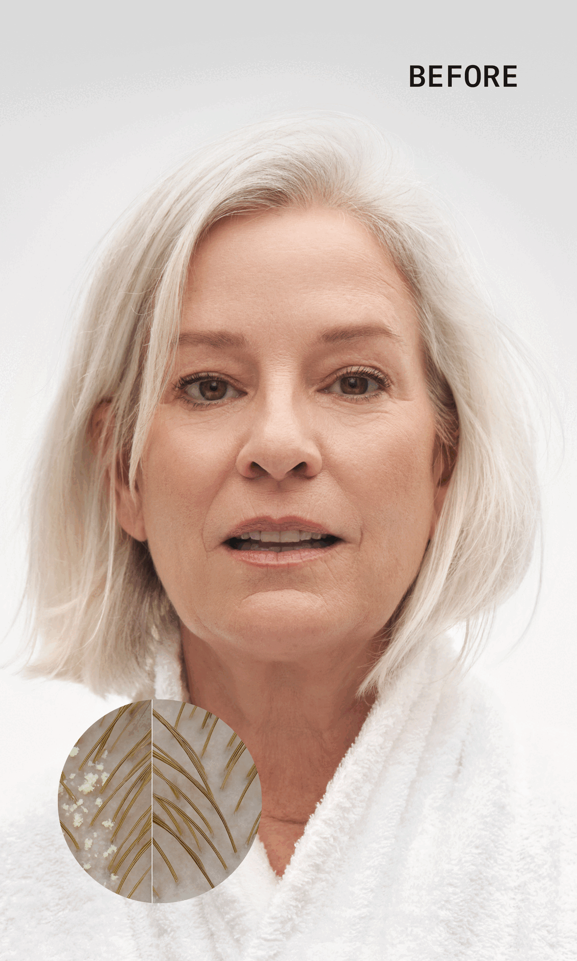 Woman with short white hair, wearing a white robe, with 'BEFORE' text above.