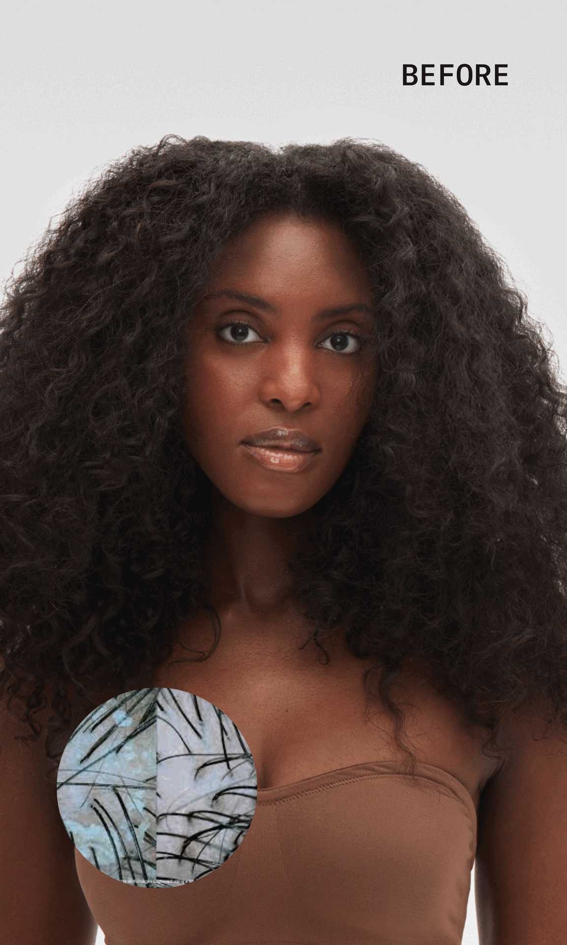 Woman with curly hair, close-up of scalp, text 'BEFORE' at top.