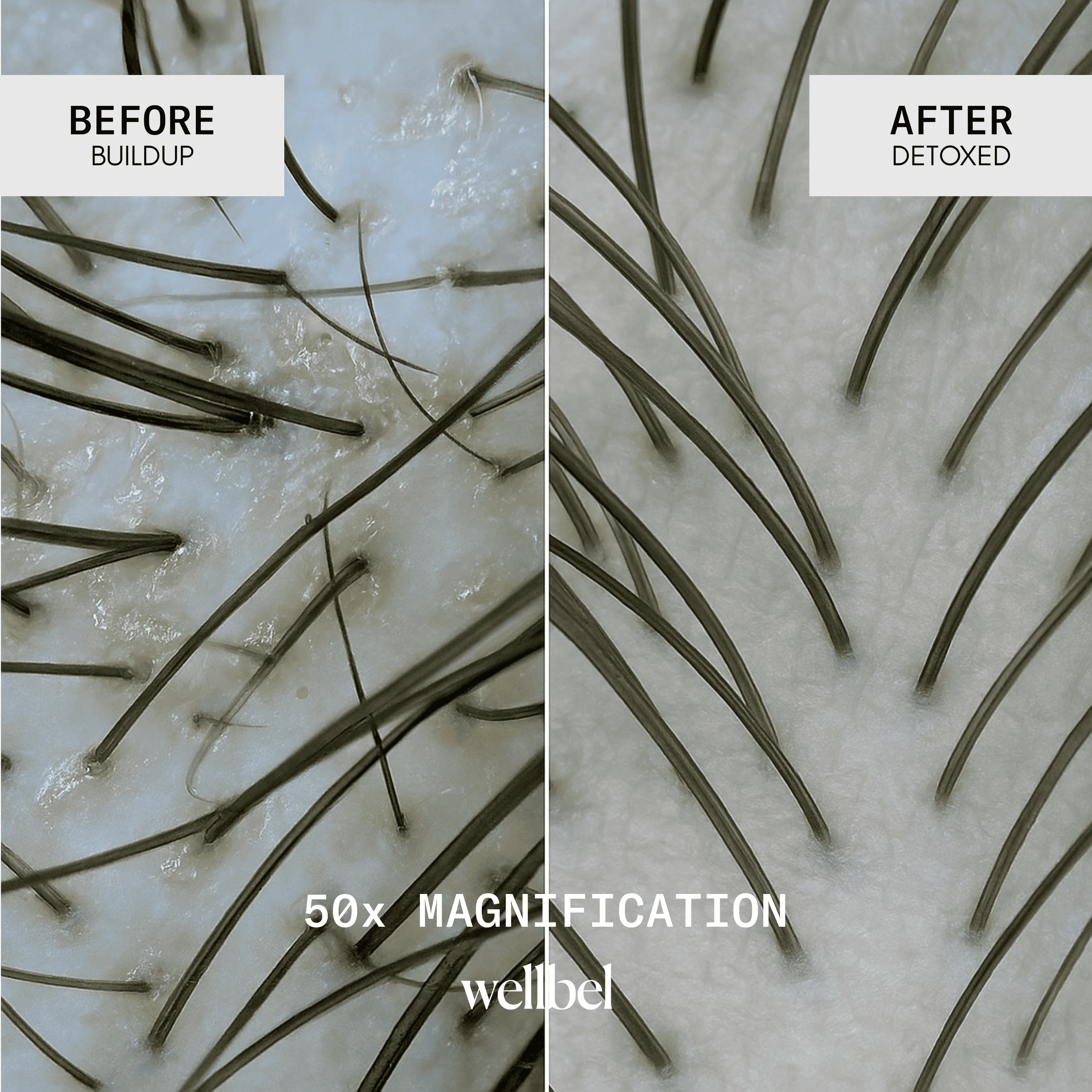 Close-up of scalp before and after detox, showing hair follicles.