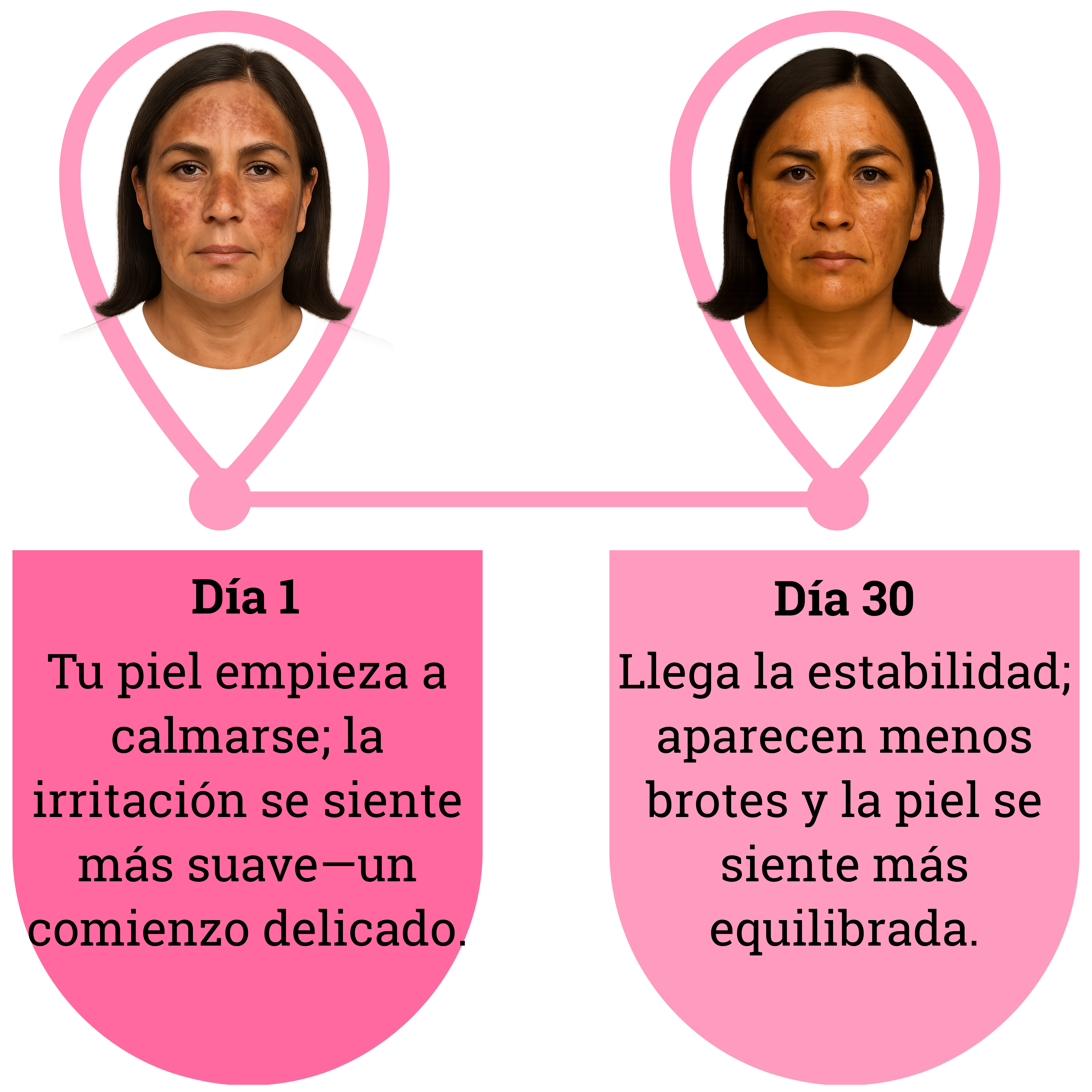 Two images showing a skincare progression from day 1 to day 30 with text in Spanish.