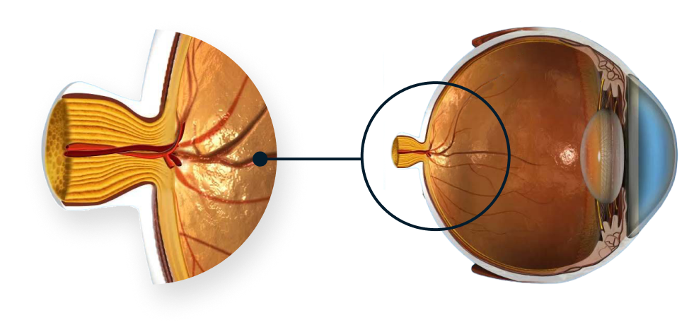 Schéma de l’anatomie de l’œil mettant l’accent sur le nerf optique.