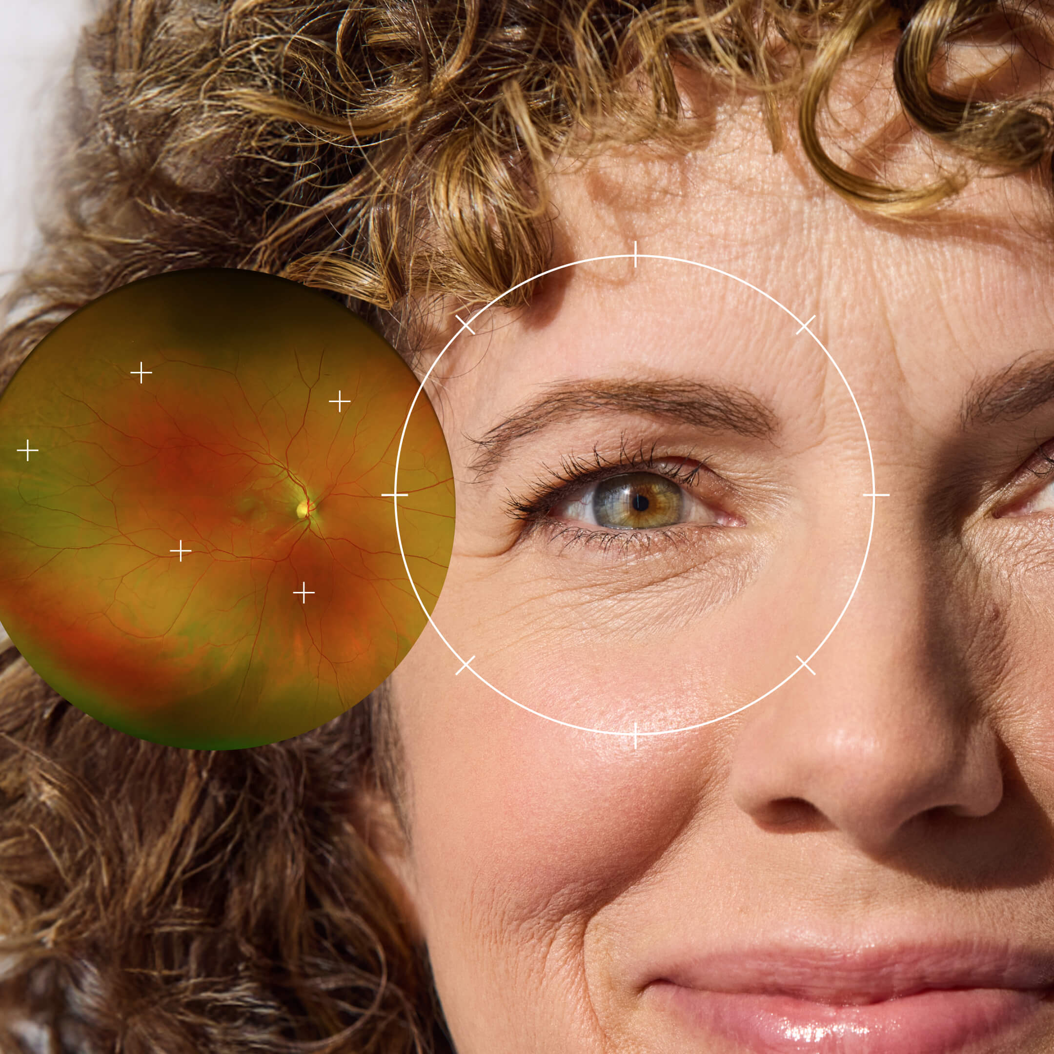 Close-up of a woman's eye with an overlay of an eye scan image.
