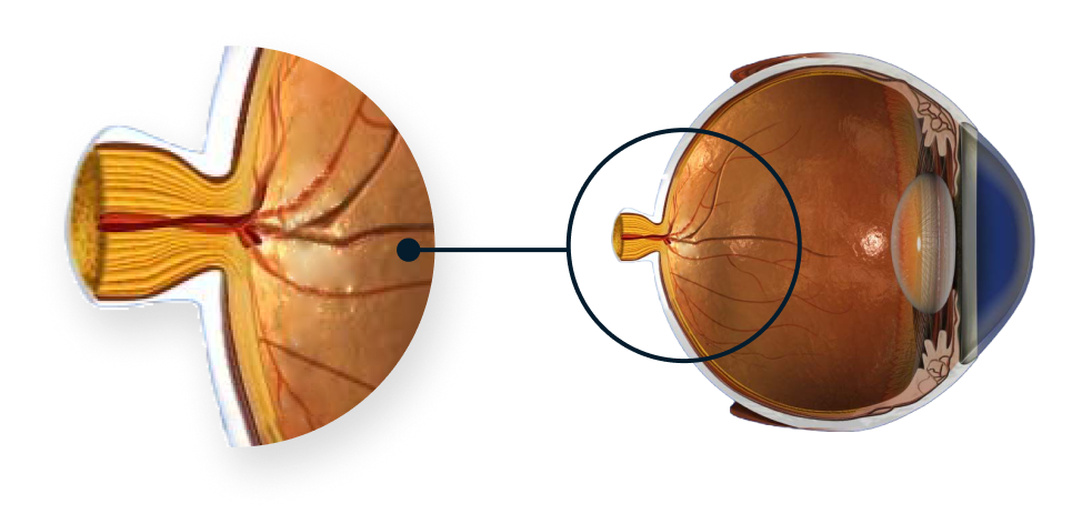 Schéma de l’anatomie de l’œil mettant l’accent sur le nerf optique.