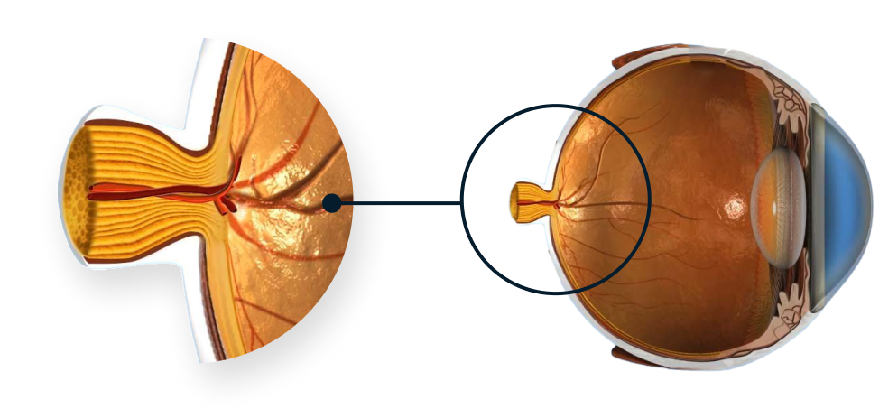 Schéma de l’anatomie de l’œil mettant l’accent sur le nerf optique.