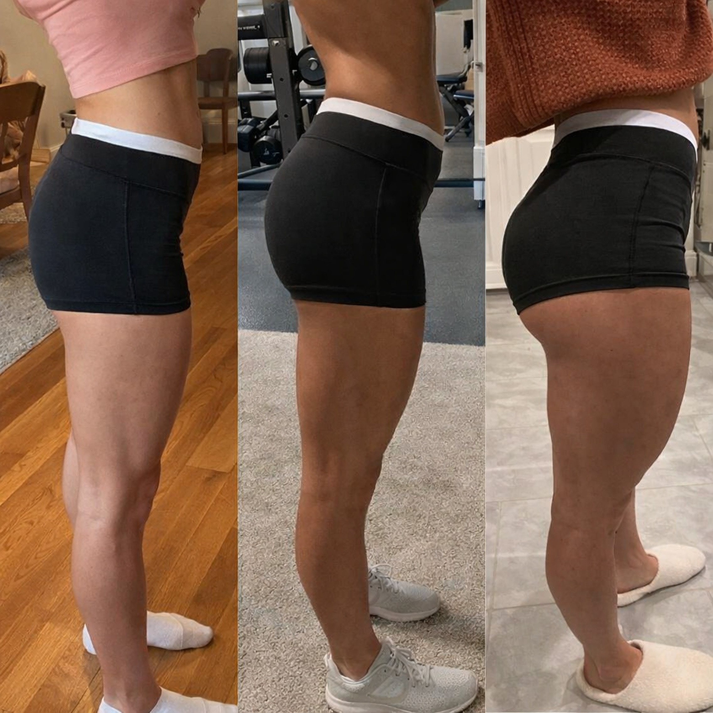 A three-panel comparison photo showing the side profile of a woman's legs and glutes.