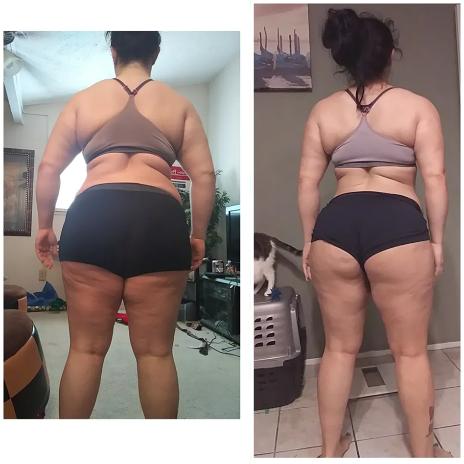A side-by-side comparison of a woman's back, showing a body transformation from a larger to a slimmer physique.