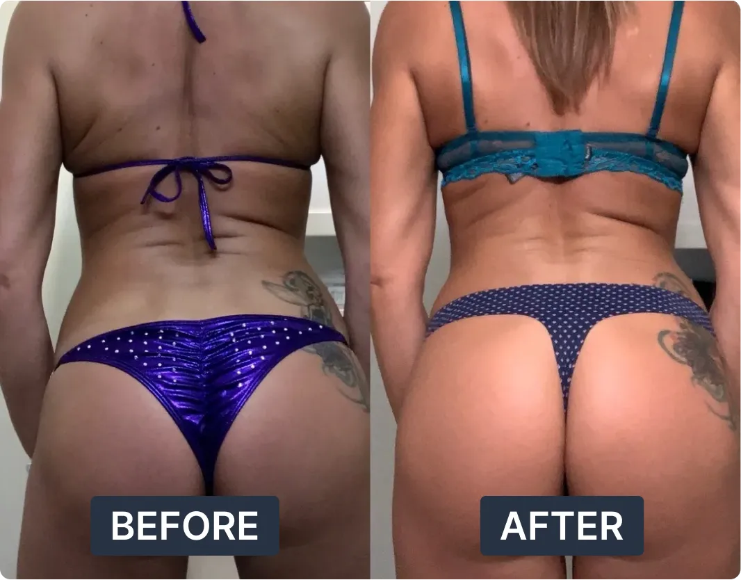 A before and after comparison photo showing a woman's back and glute transformation.