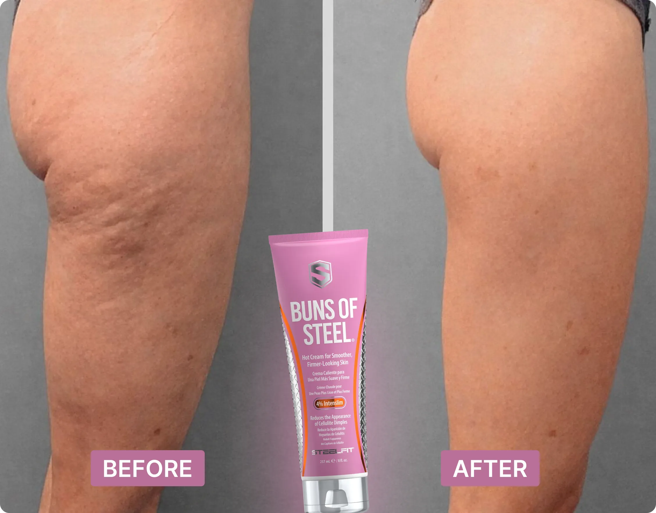 A before and after comparison of cellulite on a person's thigh, with a tube of 'Buns of Steel' cream.