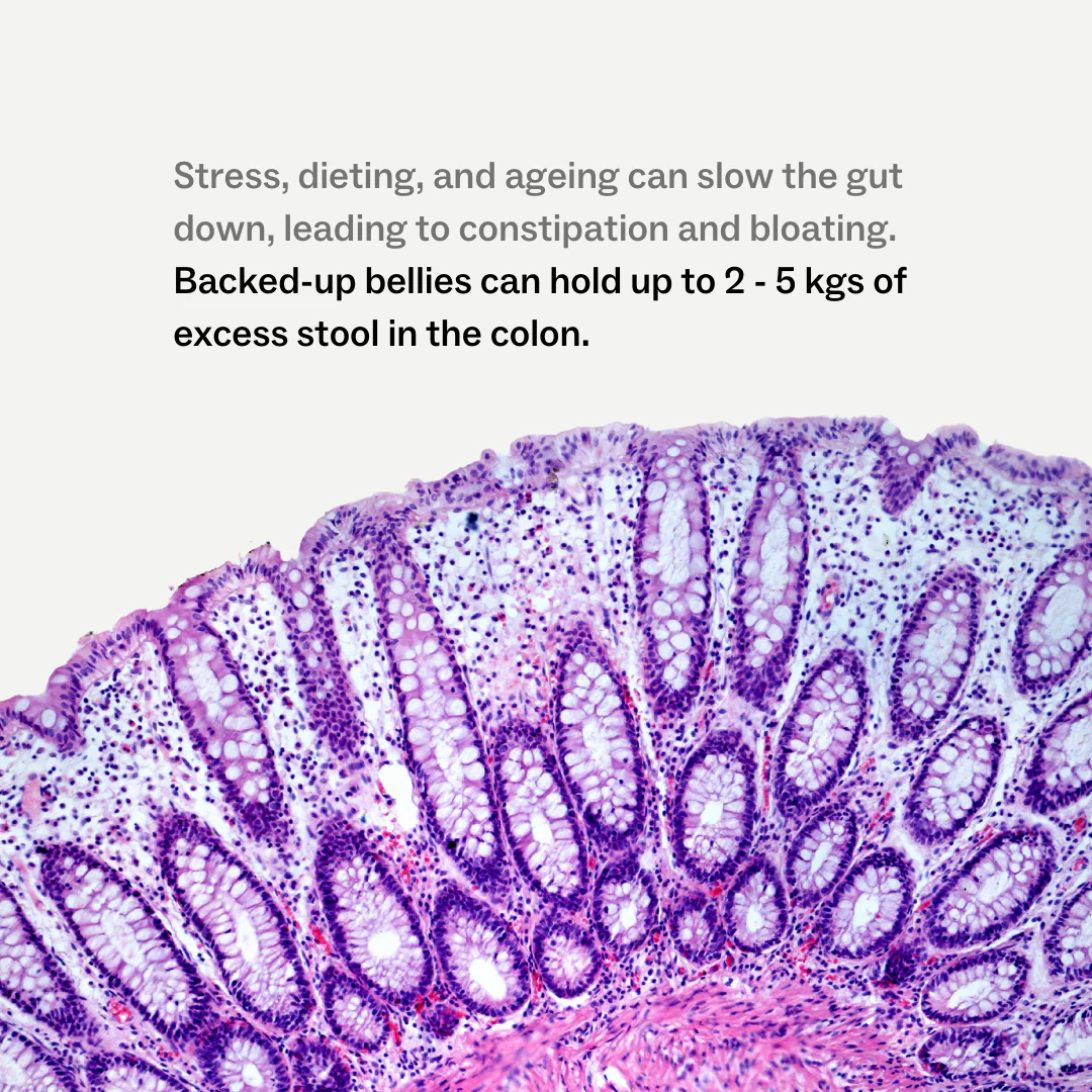 A microscopic, cross-sectional view of colon tissue stained purple, with text about gut health above.