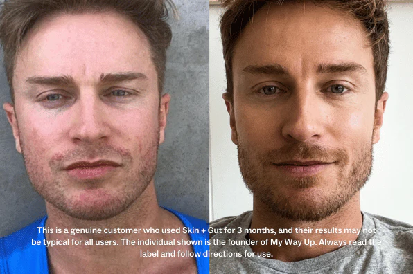 Side-by-side comparison of a man's face before and after using a skincare product.