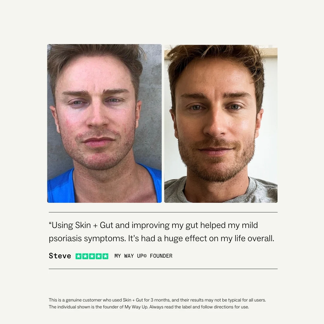 Before and after photos of a man with improved skin condition.