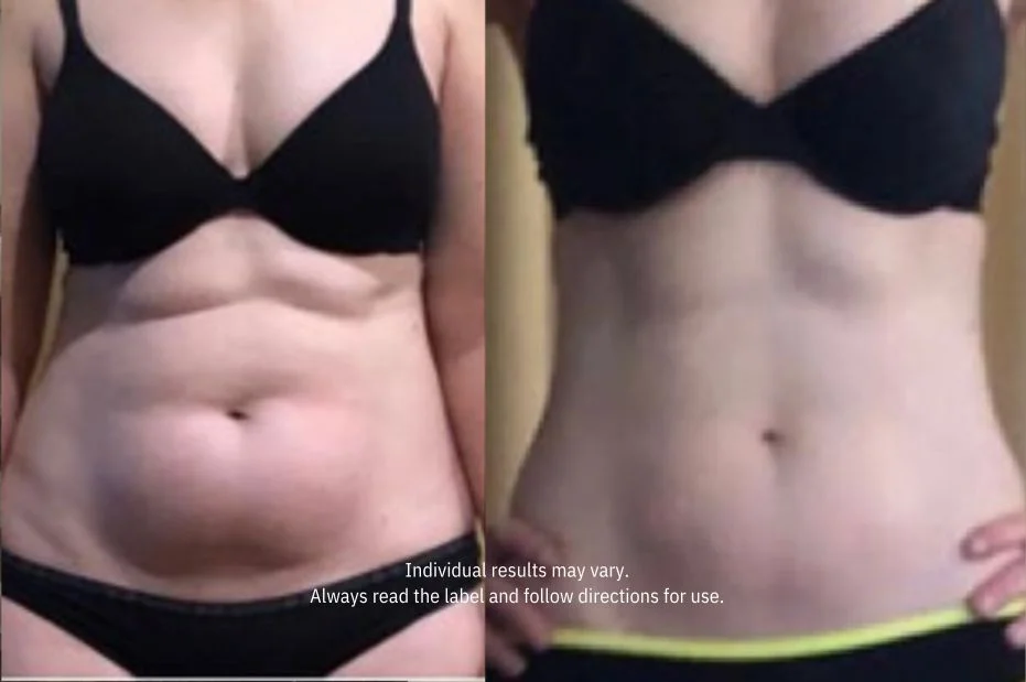 A before and after image showing a woman's torso with a noticeable reduction in stomach fat.