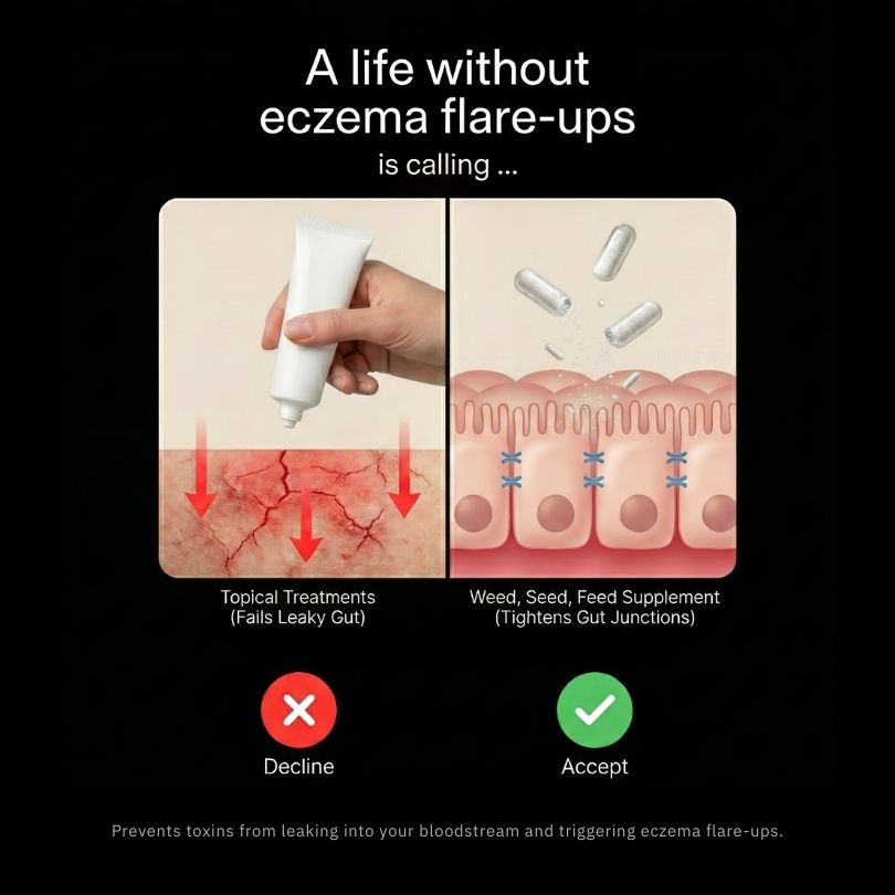 Comparison of eczema treatments: topical vs. supplement with gut illustration.