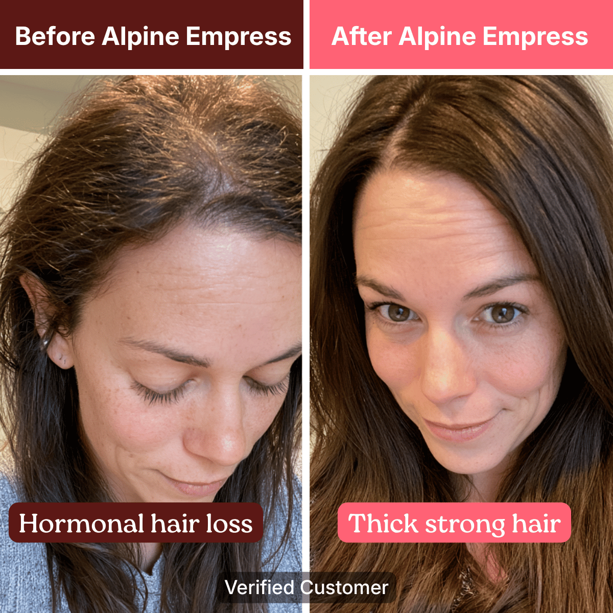 Before and after photos showing a woman's hair looking fuller and thicker after treatment for hair loss.