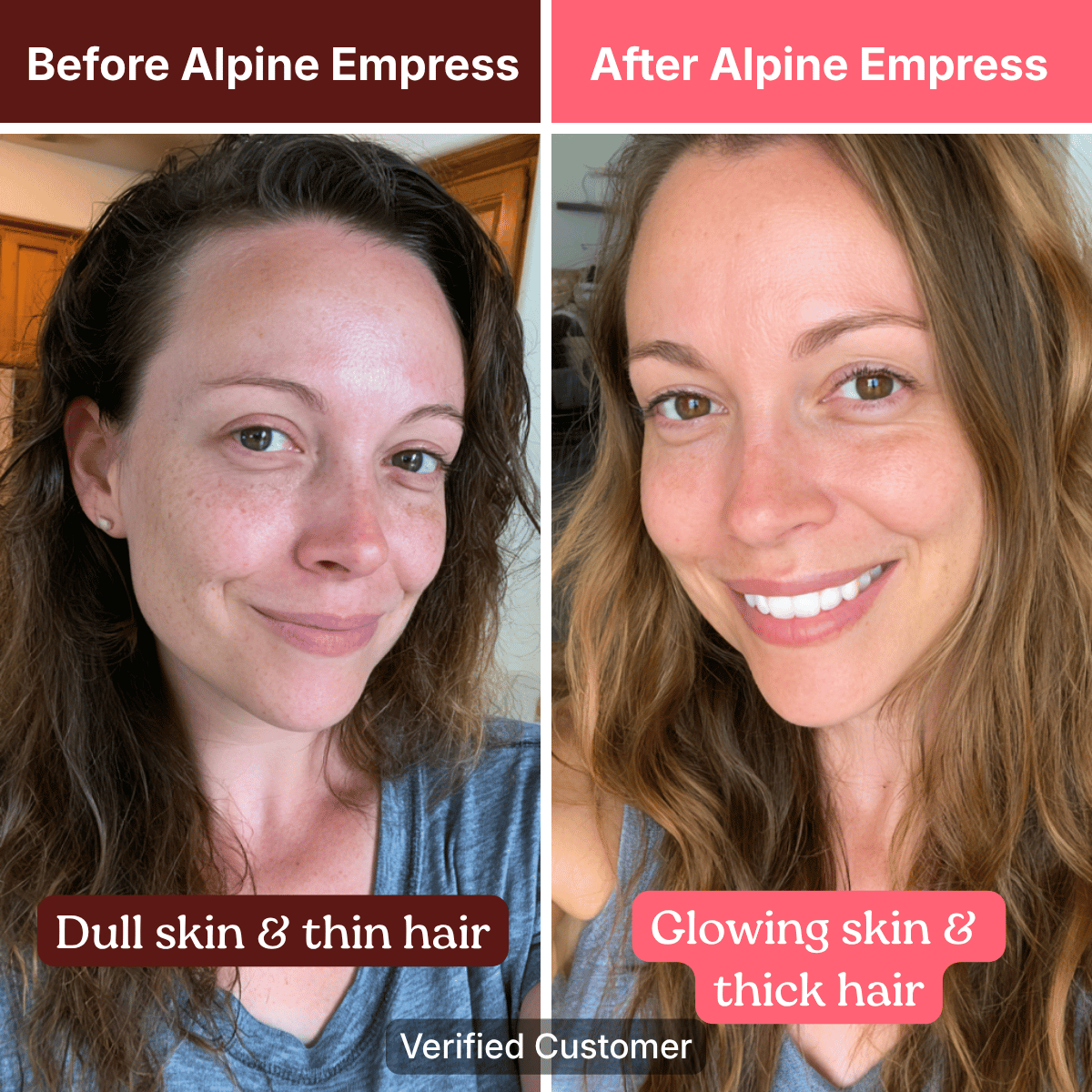 A before and after image showing a woman's transformation, with clearer skin and fuller hair in the after photo.