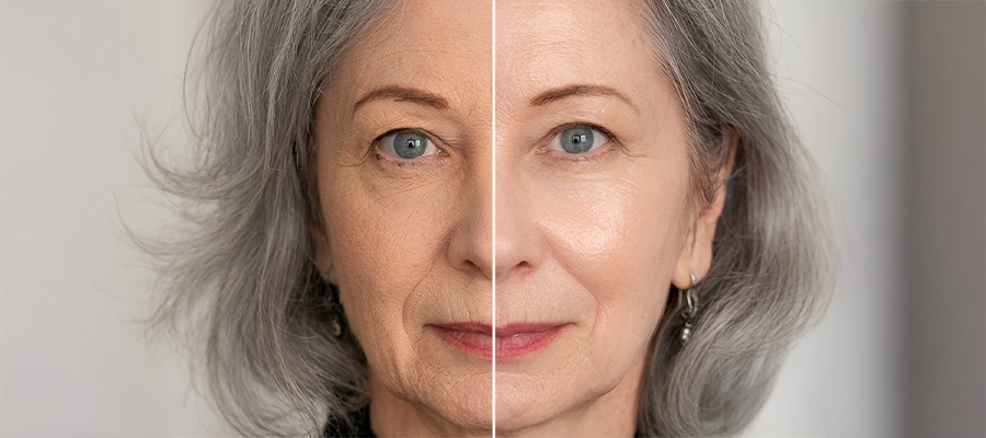 A split image showing an older woman's face, comparing wrinkled skin on the left to smoother skin on the right.